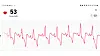 Alt vel: Mesteparten av tiden ser EKG-ene ut slik. Det betyr jevn puls og alt vel. Men skytjenesten gjør mange andre analyser som kan avsløre flere ulike typer arytmi. Slik som et betydelig antall dobbeltslag når jeg sover.