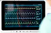 X, Y og Z-bevegelser: Akselerometeret måler bevegelse i tre retninger. Vegghastigheten til ventrikkelen er et kjent mål for hjertefunksjon som benyttes ved bruk av ultralyd og vevsdoppler. Foto: Cardiaccs