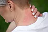 Myggstikket klør, men gift-effekten handler først og fremst om at blodet ikke koagulerer og at du blir bedøvet i stikkøyeblikket.