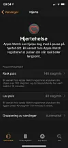 Varsel om ujevne hjerterytmer – og etter hvert mulighet for EKG-måling fra klokka – er nyttige funksjoner i Apple Watch Series 4.